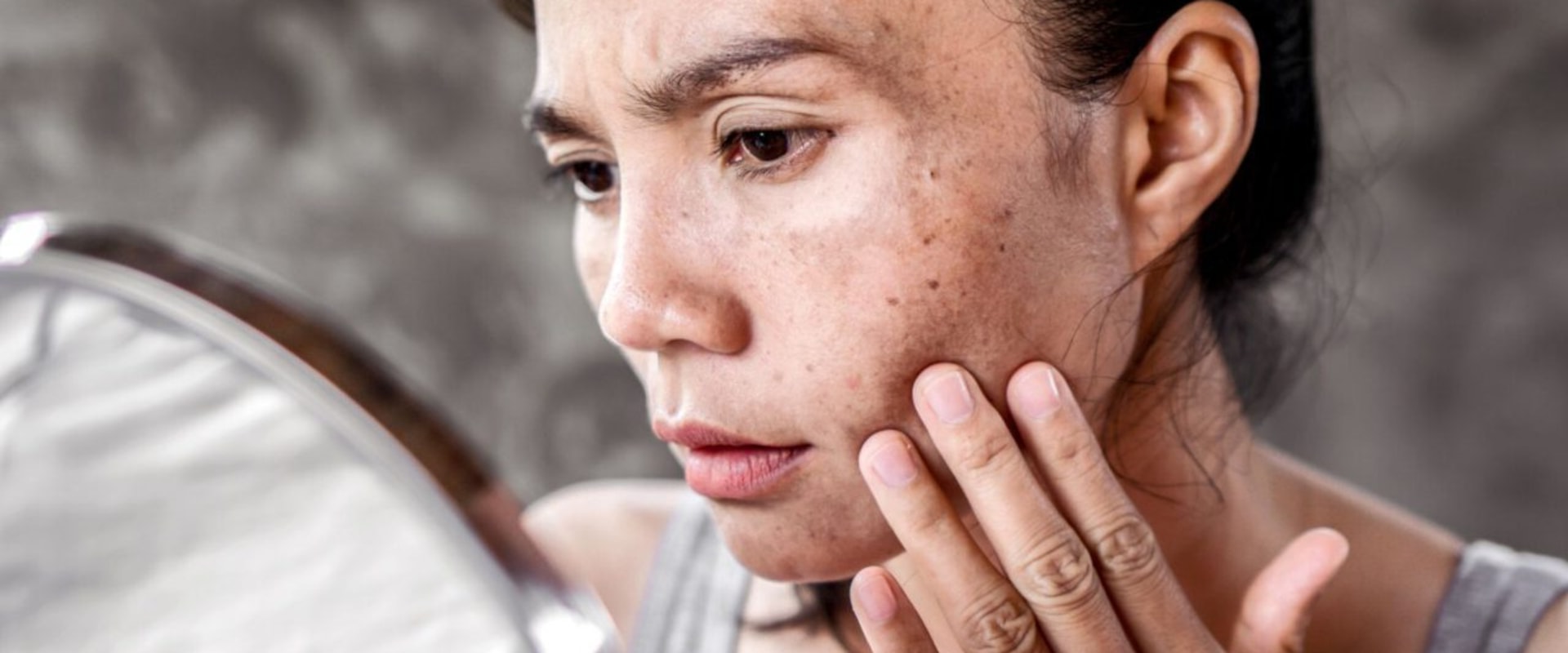 Understanding Skin Disorders and Their Impact on Sagging Skin