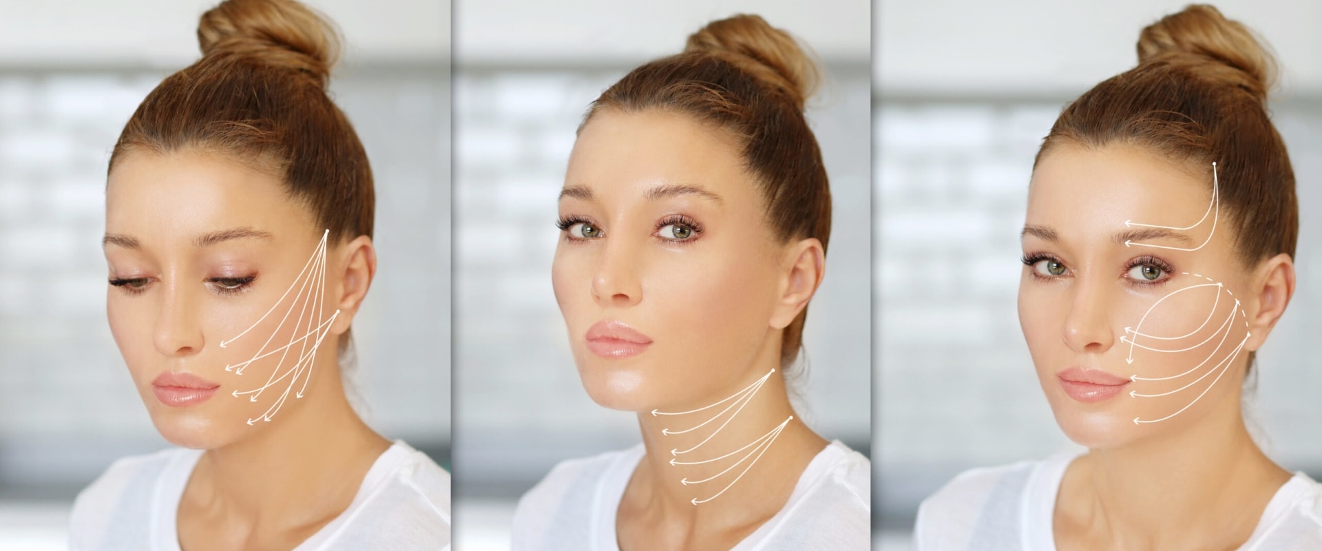 How to Get Firmer, Youthful-Looking Skin: A Complete Guide to Thread Lifts