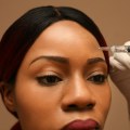 How Injectable Fillers Can Help Tighten Loose Skin