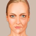 Understanding Loss of Facial Fat and Bone Density