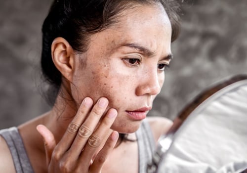 Understanding Skin Disorders and Their Impact on Sagging Skin