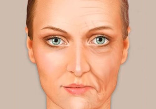 Understanding Loss of Facial Fat and Bone Density